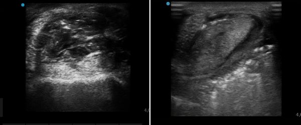 ecografia lesione tendinea cavallo
