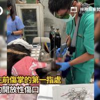 MLS® treats the injuries on a bear's paw - Taichung City