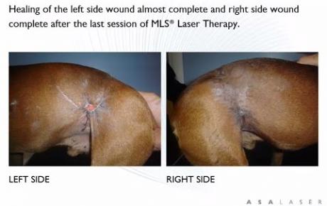 Embedded thumbnail for Percy, el tratamiento de heridas por mordeduras infectas