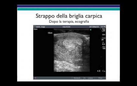 Embedded thumbnail for Strappo tendineo in un cavallo da sella